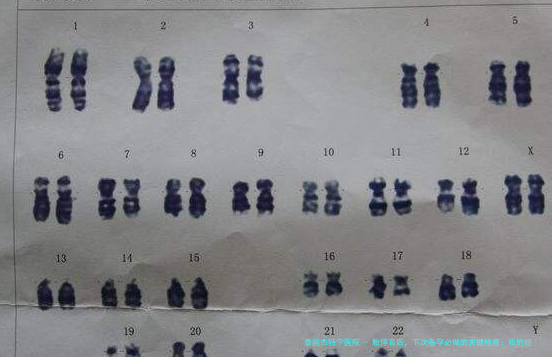 胎停育后，下次备孕必做的关键检查：我的经验与科学指南
