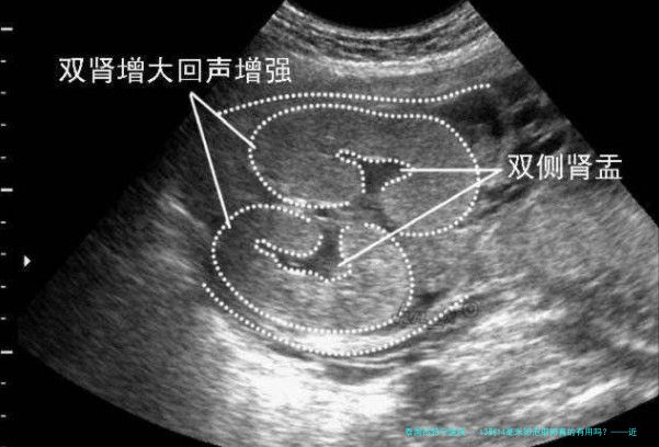 13到14毫米卵泡取卵真的有用吗？——近5年数据深度解析