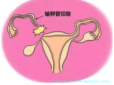 科学备孕指南：掌握正确姿势动作，轻松迎接新生命
