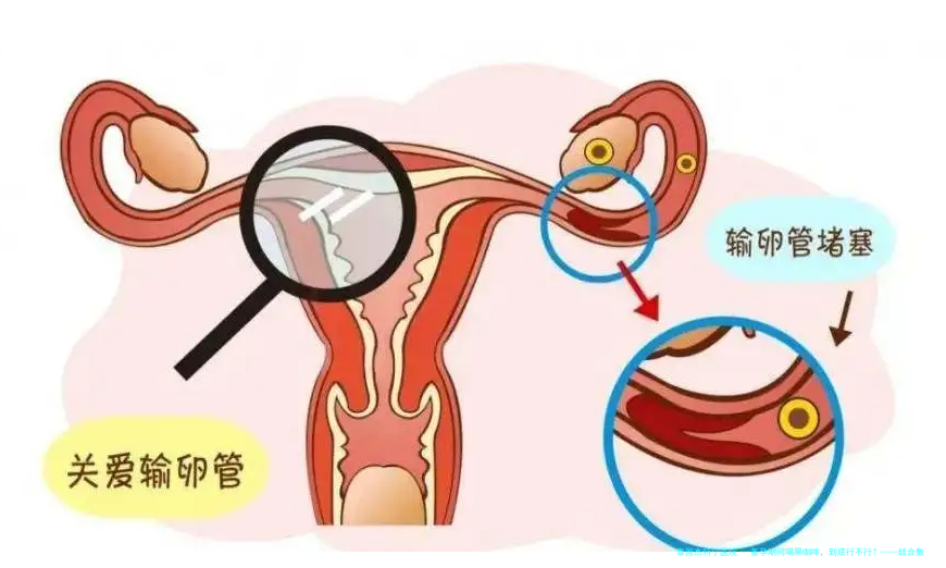 备孕期间喝黑咖啡，到底行不行？——结合数据为你揭秘