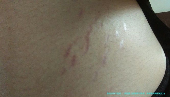 试管婴儿的智商与寿命：科学数据揭秘真实情况