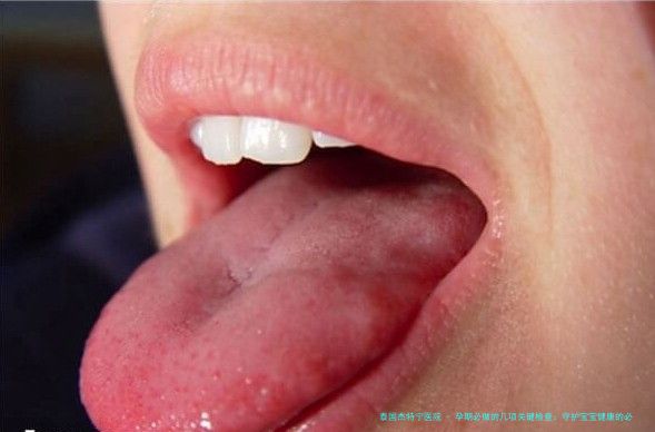孕期必做的几项关键检查：守护宝宝健康的必经之路