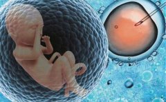 为什么试管专家都建议试管婴儿单胚胎移植？