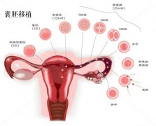 试管婴儿胚胎移植有哪几种方式？