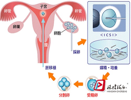 泰国试管攻略之运动篇，注意事项了解一下