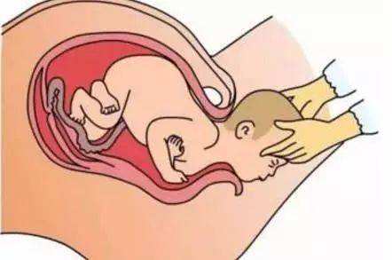 婴幼儿阴道炎症状表现有哪些?